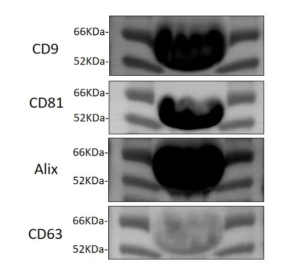外泌体标志蛋白表达情况